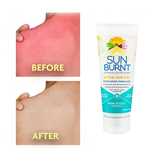 Sunburnt¢ç Lotion 6 Fl Oz and Gel 6 Fl Oz After Sun Skin Care Bundle Much More than Aloe
