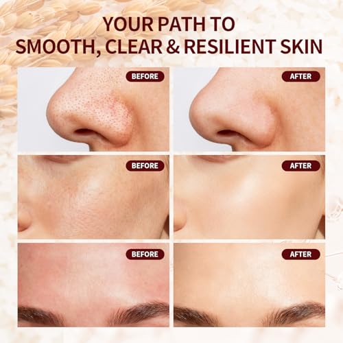 Peeling Shot Glow Rice Exfoliant Ampoule, 5% Complext Acid Gentle Exfoliating Serum with Salicylic Acid, Brightening and Smoothing for Sensitive Skin