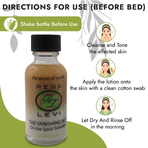 Acne Spot Pimple Drying Lotion - For Face and Body Use, Dries Out Blemishes and Pores - 1oz