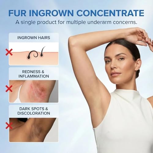 Ingrown Hair Treatment Serum ? Smoothing Solution for Razor Bumps & Hair Removal Aftercare | Hydrating Care for Underarms, Legs, Bikini Line & Arms