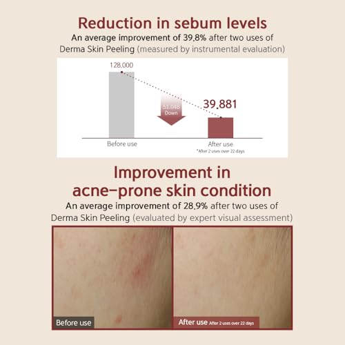 [BQCELL] [Made In Korea] [DERMA SKIN PEELING 2g / Recell Cure Serum 2ml, Safety Cap 1ea, 3set], Acne Skin Available, Exfoliating, Facial Scrub, Korean Beauty, Blackhead Remover