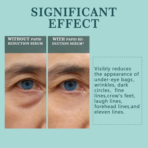 Instant Under Eye Lift Serum - Instant Eye Tightener Cream, Tightener Cream for Under Eye Bags and Wrinkles, Fine Lines, Dark circles, Anti-Aging Wrinkle Remover, 0.5FL.OZ