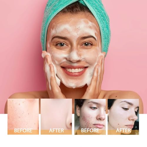 2 Pcs Turmeric Facial Cleanser, Deep Cleansing Brightening Exfoliating Turmeric Foaming Face Glow Wash with Brush for All Skin