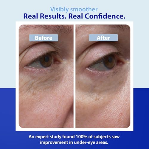 Dr. Denese SkinScience Firming Facial Collagen Eye Cream 1oz ? Hydrating Under Eye Treatment with Hyaluronic Acid, Peptides & Ceramides for Puffiness, Dark Circles, Fine Lines ? Cruelty-Free Skin Care