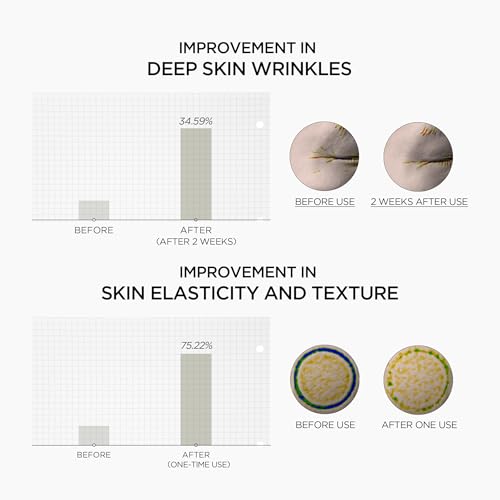 SKIN1004 Retinol 0.2% Boosting Shot Ampoule, Face Serum for Skin Elasticity, Facial Spicule Serum with Retinol & Retinal, Centella Ampoule for Fine Lines & Wrinkles, Korean Skin Care, 1.01fl.oz / 30ml
