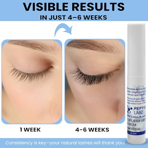 Eyelash Growth Serum ? Myristoyl Pentapeptide-4, Diaminopyrimidine Oxide ? Boosts Lash Length, Density & Strength ? Supports Fuller, Thicker Eyelashes Naturally, 5ml
