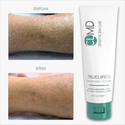 CLMD TrueLipids Ceramide+ Cream ? Deep Moisturizing Barrier Support for Sensitive Skin ? Hydrates and Soothes ? Hypoallergenic, Nourishing, and Dermatologist-Tested ? 3.4 fl oz