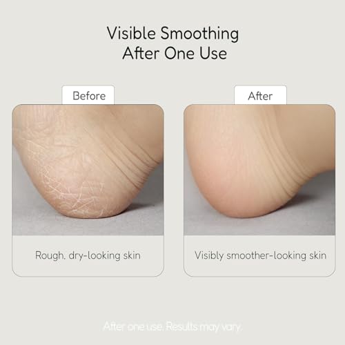 BUFFOUT Callus Eraser Exfoliating Gel ? Body Care Exfoliator Scrub & Exfoliant for Feet, Heels, Elbows & Knees ? Dead Skin Care with Perlite & Apricot Seed Powder