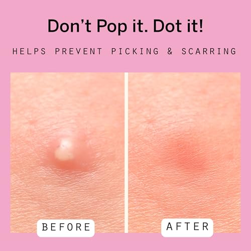 Pixie Cup Dot Hydrocolloid Blemish Patches for Face ? Invisible Skin-Covering Stickers with Tea Tree Oil & Vitamin C ? Ultra-Thin Cosmetic Patches for Visible Blemishes (8 & 12 mm, 108 ct)