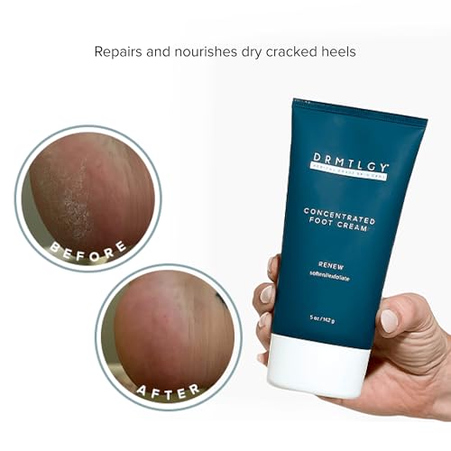 DRMTLGY Concentrated Foot Cream for Dry Cracked Heels - Heel Cream & Foot Lotion for Dry Cracked Feet -Dry Feet Treatment for Women & Men (Pack of 2)