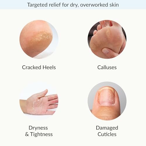 Epielle Intensive Repairing Hand & Foot Masks, Restore and Moisturize Dry, Cracked Skin, Self Care Gifts for Women, Spa Kit, Stocking Stuffers, 6 Moisturizing Gloves & 6 Moisturizing Socks