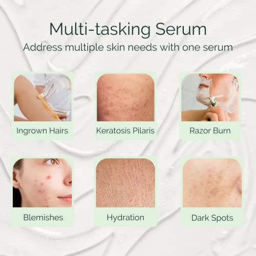 Serious Serum Exfoliating Ingrown Hair Serum ? Glycolic, Lactic & Salicylic Acid Formula for Smooth Skin ? Razor Bumps, Ingrown Hairs & Razor Burn ? Hydrating Formula for Post-Shave & Waxing Care
