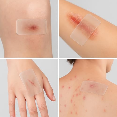 Clear Scar Sheets ? 10 Pieces ? Skin Patches for Face and Body ? Use Before Scars Fully Form ? Prevent and Reduce Scars from Acne, Scalds, Burns, Cuts, Abrasions ? Thin, Flexible, Waterproof, Gentle