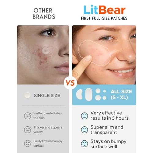 LitBear Large Acne Pimple Patches, 6 Sizes 100 Patches for Large Breakouts, Acne Patches for Face, Chin or Body, Acne Spot Patch with Tea Tree & Calendula Oil, Hydrocolloid Bandages for Acne Skin