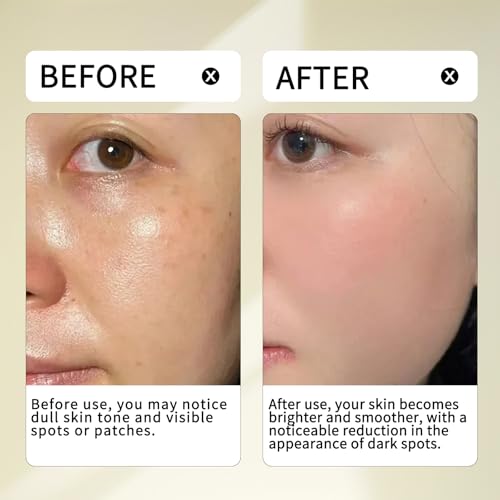 Luminous 24% Bright Complex ? 10% Niacinamide, 7% Arbutin, 4% VC Ether, 3% Tranexamic Acid ? Revitalize Skin Surface & Enhance Natural Glow