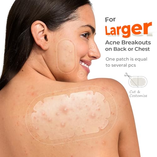 XXL Pimple Patches for Body, Large Acne Patches, 5 Sizes Big Hydrocolloid Bandages for Back, Chest, Shoulders Zit Breakouts, Blemish Stickers for Face (Oval, Dot 110 Count)