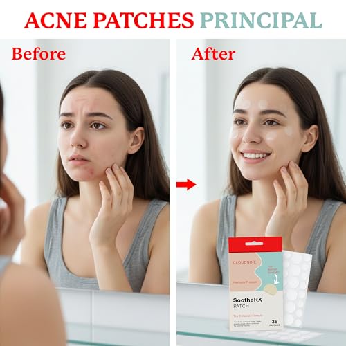 SootheRX Hydrocolloid Acne Patches for Face | Niacinamide Pimple Patch | Overnight Blemish & Acne Spot Treatment | Pimple Stickers for Covering Cheeks & Zit Patch for Face | 36 Count Transparent