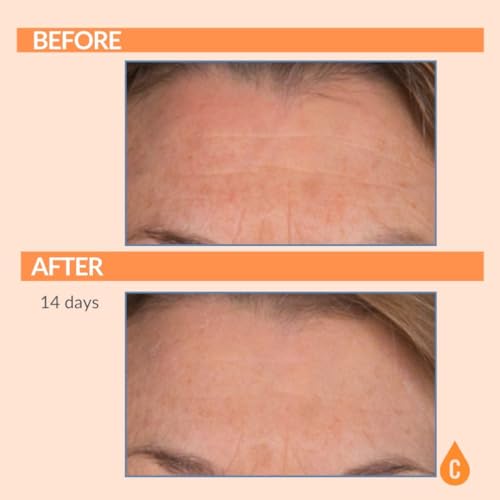 Serious Skincare Vitamin C Serum for Face, Anti-Aging Face Serum with Collagen, Vitamin E, Hydrating Skin Care for Brightening, Improve Appearance of Dark Spots, Tone, Fine Lines & Wrinkles 1 Fl Oz