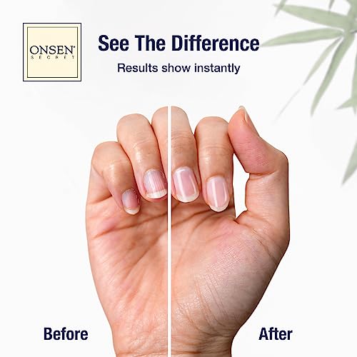 Onsen Secret Ultimate Nail Reboot Kit - Includes Cuticle Oil & Anti Aging Hand Lotion, Professional Nail File and Buffer, 3-Way Block w/Replacement Pads, Nail Strengthening Cuticle Cream