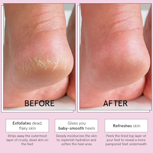 grace & stella Award-Winning Foot Peel Mask - Foot Peeling Mask with Aloe Vera - Moisturizing Foot Mask for Dry Cracked Feet - Foot Exfoliator for Baby Soft Feet (4 Pairs, Lavender) (Pack of 2)