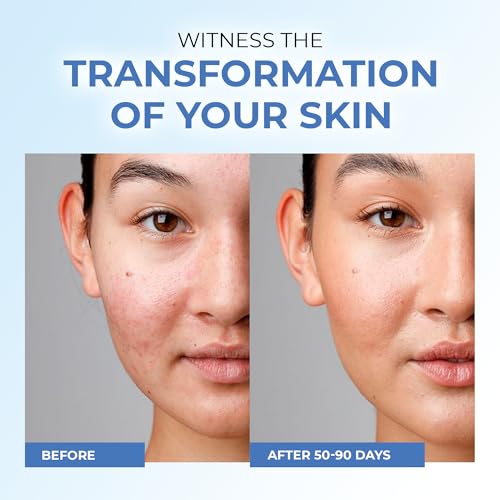 Niacinamide Face Serum With Vitamin C, Hyaluronic Acid - Moisturizes, Refreshes, Removes Pigmentation - Niacinamide Hyaluronic Acid Serum - 30ml