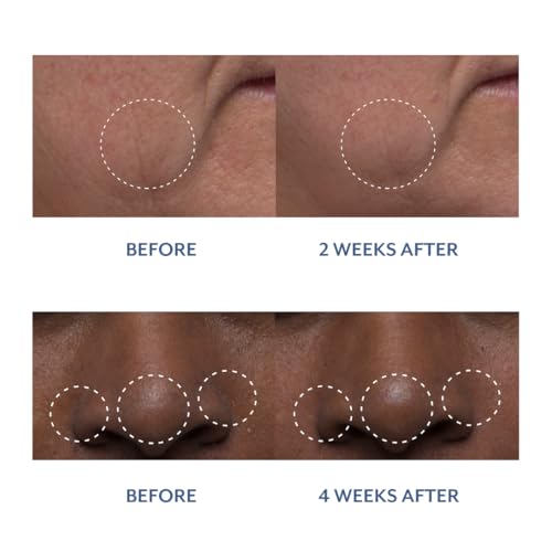 Bloomeffects - Natural Tulip Dew Drops Multi-Nutrient Serum | Cruelty-Free, Non-Toxic, Clean Beauty (1.0 oz | 30 ml)