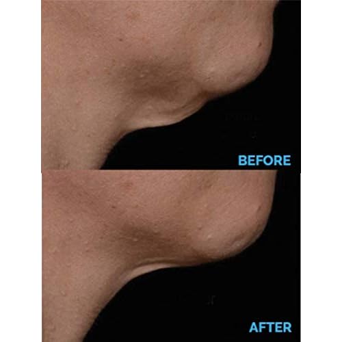 AminoGenesis N.E.C.K Control: Neck Lifting, Firming And Retracting Cream