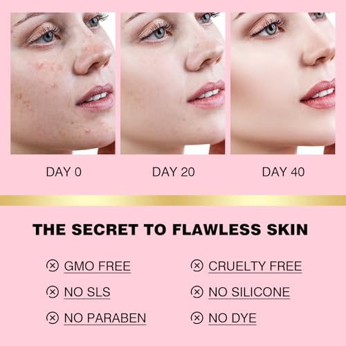 Salicylic Acid Scrub Soap, Face Bath Soap Bar with Glycolic Acid Tea Tree, Exfoliating Face Body Wash for Women & Men Anti-blemish Acne Strawberry Legs Ingrown Hair Keratosis Pilaris 200g/7OZ