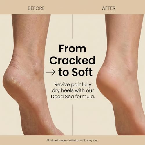 SEACRET Minerals Foot Cream, Enriched with Shea Butter, Tea Tree Oil and Dead Sea Minerals, 3.4 Fl Oz / 100 ml
