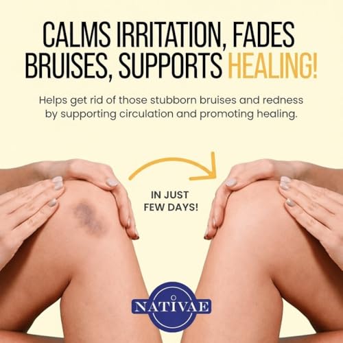 Helichrysum Balm ? Helichrysum Italicum Essential Oil Skin Cream for Bruises, Veins, Burns & Redness ? Soothing Healing Moisturizer for Face & Body