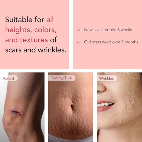 Silicone Scar Sheets (1.6"x 118" Roll-3M) - Silicone Scar Tape for Scar Removal Treatment, Reusable Strips for C-Section, Keloid, Burn, Acne, and Surgical Scars with Folding Scissors
