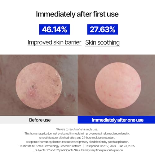 MILLIMILLI MediAmpoule ? Cica Serum | Calming Centella Asiatica Face Ampoule with TECA & Panthenol | Hydrating Korean Skin Care Serum for Face, 15ml