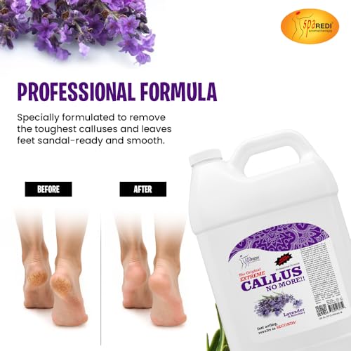 SPA REDI Callus Remover - Removes Toughest Calluses in Seconds and Smooths Dry Cracked Heels, Softens and Smooths Feet, Lavender & Rosemary - 128 Oz