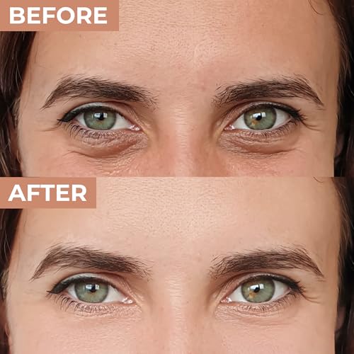 Peptide Eye Cream ? Hydrating, Fragrance-Free Eye Cream for Dark Circles, Puffiness & Fine Lines ? Lightweight Under Eye Cream to Smooth, Refresh & Revive Tired-Looking Eyes ? 30ml