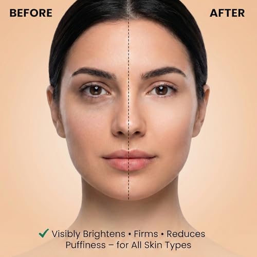 Nourishing Miracle Under Eye Cream ? Treats Dark Circle & Fine Lines, Firms, Brightens & Hydrates Around Eye Area, Anti Aging Eye Cream with LARVOGEN¢â Bio Oil Peptides & Jojoba Oil, 30g