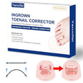 Nitinol Ingrown Toenail Corrector,at Home Ingrown Toenail Treatment,Curved Toenail Straightener,Ingrown Toe Nail Relief£¬Ingrown Toenail Removal Kit (1/2 In,11/16 In)