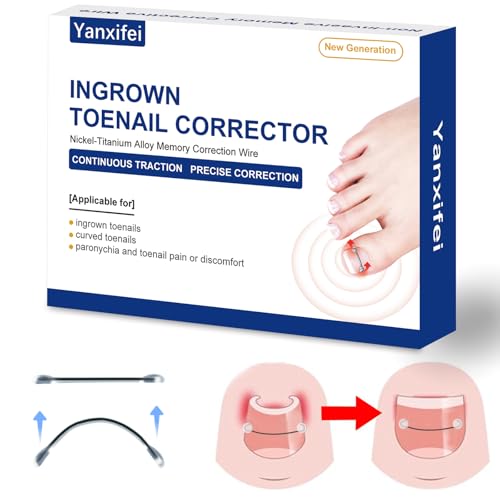 Nitinol Ingrown Toenail Corrector,at Home Ingrown Toenail Treatment,Curved Toenail Straightener,Ingrown Toe Nail Relief£¬Ingrown Toenail Removal Kit (1/2 In,11/16 In)