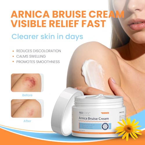 Arnica Cream Extra Strength for Thin Skin, Arnica Montana Cream with Vitamin K C & E, Fast Absorbing Hydrating Cream for Face and Body, Supports Skin Recovery Appearance, 4.23 oz
