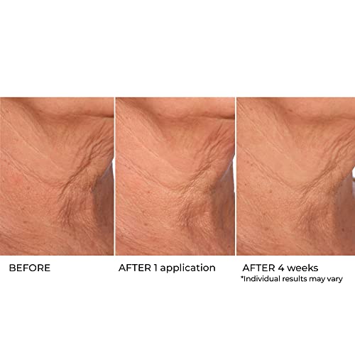 NassifMD Age Defying Neck & D?collet? Serum, Lifts and Firms Thin Neck Skin, Hydrates and Smooths