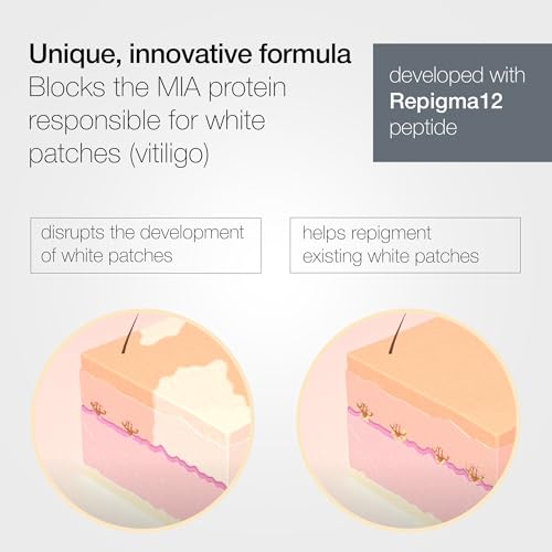 LULLAGE Repigment12 White Patches Corrector Cream for Dry Skin and Sensitive Skin, Paraben-Free Repigmentation Face and Body Cream for Women and Men, 2.5 Fl Oz