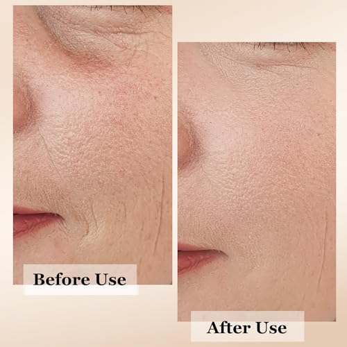 mivida 4-in-1 Anti-Aging Serum for face | Retinol, Vitamin C, Hyaluronic Acid & RoseHip Oil | multi benefit Face Serum ? 1 Fl Oz