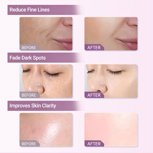 Collagen Peptide Anti-Aging Serum - Hydrating Facial Treatment with Hyaluronic Acid, Reduces Fine Lines & Wrinkles, Repairs Skin, 1 fl oz
