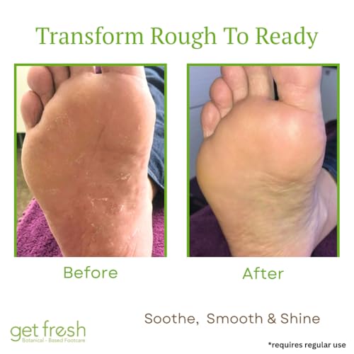 Get Fresh Rescue Me - Intensive Foot Cream for Dry Skin, Cracked Heels, and Calluses, with Shea Butter, Aloe, and Lemongrass, 170g