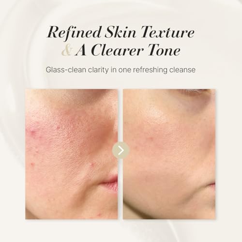 starlike White Pore LHA Fresh Gel Cleanser I LHA & Fine Grain Powder I Daily Mild Face Wash I Helps Reduce Whiteheads Buildup I Fresh & Luminous Looking Glow I Korean Skincare I 6.76 Fl oz (200ml)