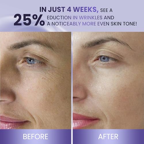 ABERA BELANI Retinol Night Cream For Women, Dark Spot Remover, Melasma Treatment, Reduce Fine Lines, Anti-Wrinkle, Anti-Aging Neck and D?collet? For Face (1 Box + Gift Eyelash Serum)