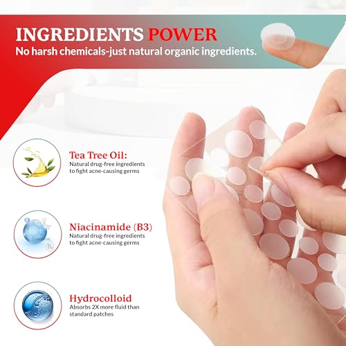 SootheRX Hydrocolloid Acne Patches for Face | Niacinamide Pimple Patch | Overnight Blemish & Acne Spot Treatment | Pimple Stickers for Covering Cheeks & Zit Patch for Face | 36 Count Transparent