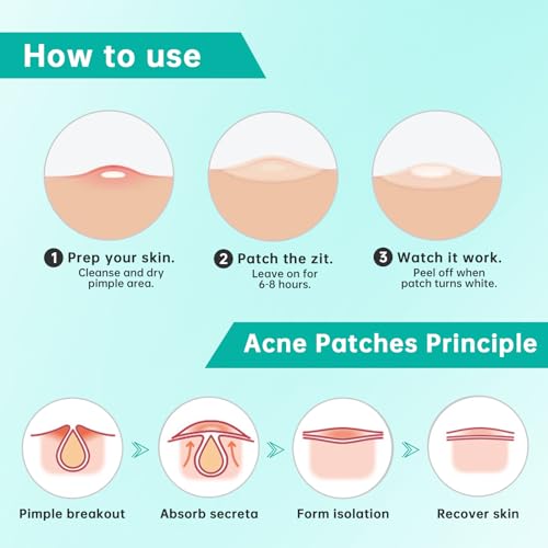 Pimple Patches for Face, Hydrocolloid Patches for Covering Zits and Blemishes, Spot Stickers with Salicylic Acid, Tea Tree Oil & Calendula Oil £¬4 Size 210 Counts Acne Patches
