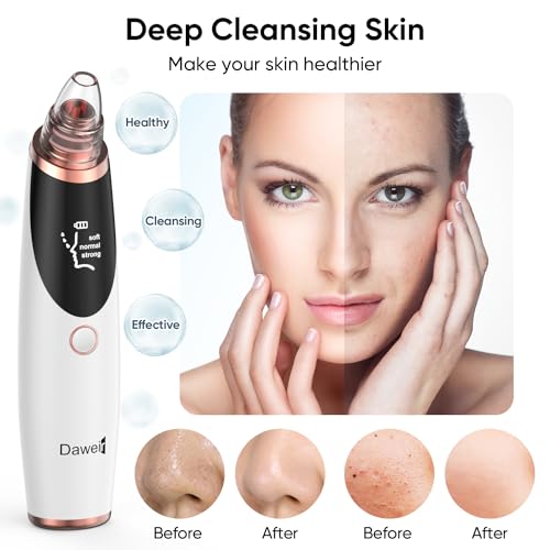 Blackhead Remover Pore Vacuum for Face & Nose ? Deep Cleansing Blackhead Remover Tools with 3 Suction Levels, 5 Replaceable Tips, USB Rechargeable Pore Cleaner