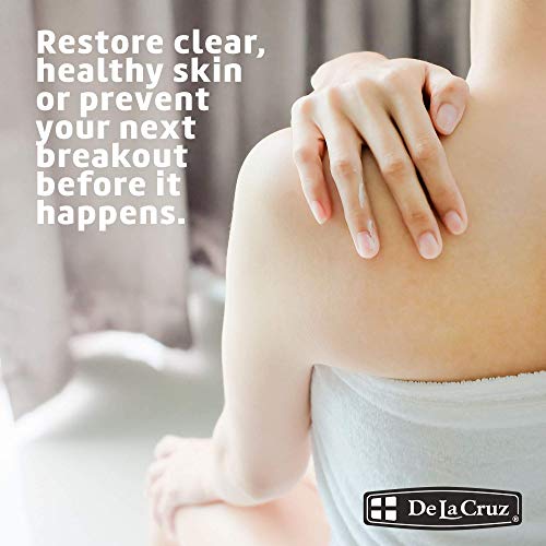 De La Cruz Sulfur Ointment - Cystic Acne Treatment for Face and Body - Daily 10 Min Spot Treatment Mask - Safe and Effective Game Changing Hormonal Acne Treatment That Clears Up Pimples 5.5 OZ.