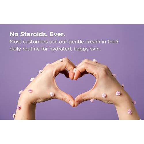 Seborrheic Dermatitis Face Cream for Sensitive Skin - Hydrates & Supports the Skin Barrier with MCT Oil, Squalane - Moisturizing Face, Scalp and Body Cream - No Steroids, Gentle Ingredients